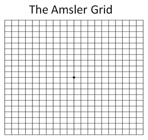 The Amsler Grid For Macular Degeneration Millennium Eye Center