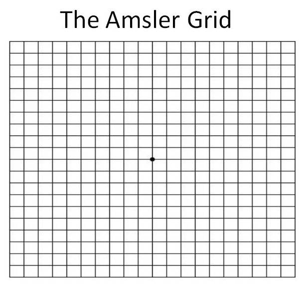 Amsler Grid  Amsler Grid Chart for Eye Test